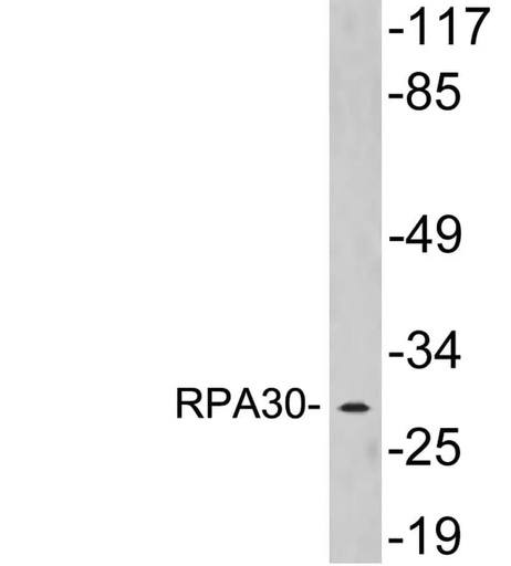 Antibodie to-RPA30 