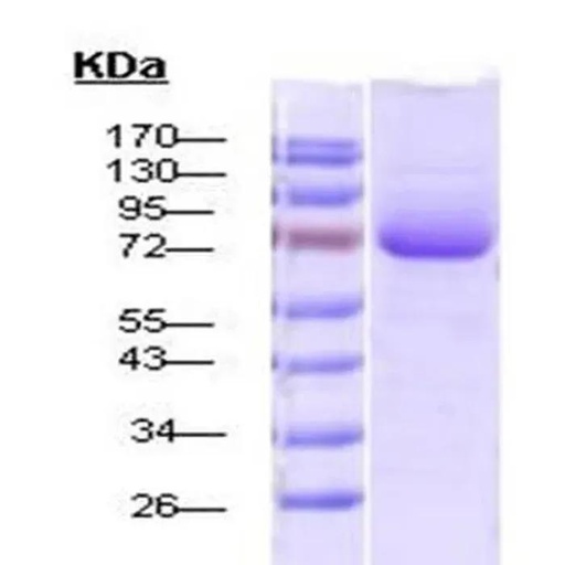 Human RAB5A protein